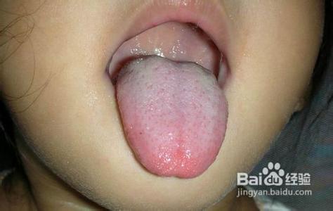 宝宝喉咙有痰怎么办 宝宝喉咙有痰有危害吗