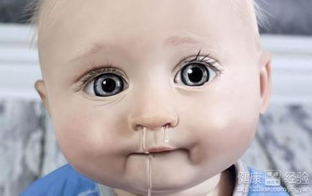 婴儿流鼻涕怎样好得快 宝宝流鼻涕怎么好的快