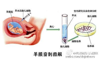 血性羊水 血性羊水怎么办