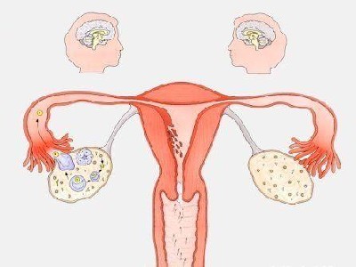 卵巢早衰原因有哪些 卵巢早衰的原因有哪些？