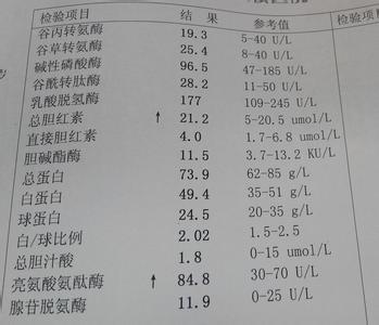 查肝功多长时间出结果 肝功能检查多久出结果