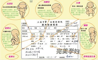 检查胎位的最佳时间 胎位检查解读