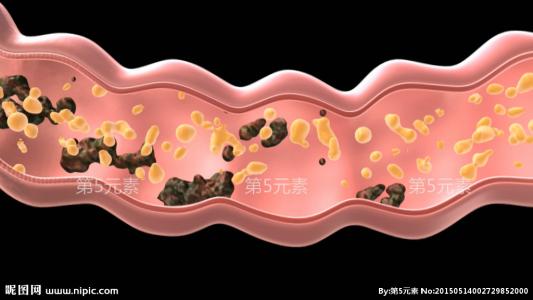 肠道不健康的六大表现 肠道内有毒素的六个表现