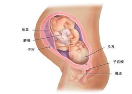 胎盘后壁的优点 胎盘后壁是不是不显怀