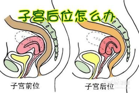 子宫后位怀孕有多难 子宫后位不易怀孕吗