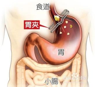 饱受摧残 你的胃是否饱受摧残？