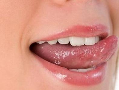 舌尖发麻是什么病兆 舌头发麻是怎么回事