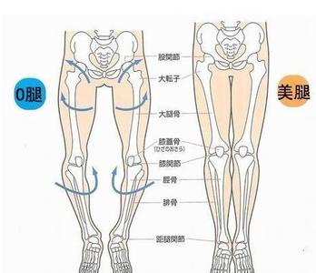 罗圈腿能矫正吗 罗圈腿与O型腿有关吗