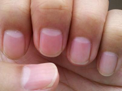 手指甲没有月牙正常吗 正常的指甲月牙有多大(3)