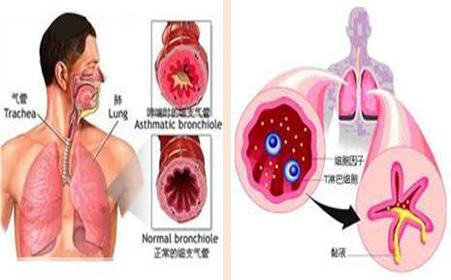 肠道寄生虫病症状 肠道寄生虫有哪些症状？肠道寄生虫怎么预防(2)