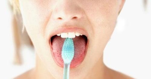 舌头发白口臭怎么办 刷舌头可以预防口臭