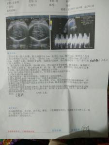 孕36周胎儿双顶径标准 36周胎儿双顶径偏大怎么办