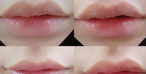 唇部护理 唇部护理四个小方法