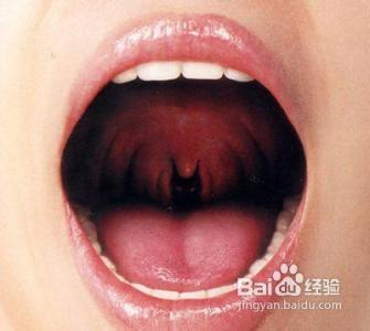 嗓子有痰是什么原因 嗓子有痰的原因是什么