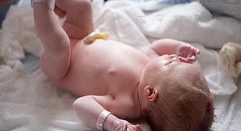 新生儿肚脐结痂正常图 新生儿如何护理结痂肚脐 新生儿肚脐的护理方法