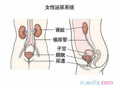 怎样预防尿结石 女人怎么预防尿道结石 尿结石的预防注意事项