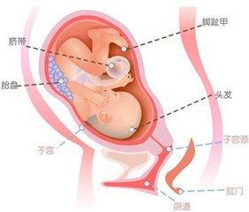 宫外孕做流产危险吗 孕早期出血要考虑流产和宫外孕的危险(2)