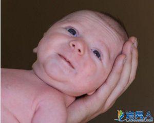 新生儿脱皮怎么护理 新生儿皮肤脱皮是怎么回事