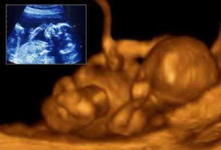 胎儿在母体内生长过程 胎儿在母体内怎样生长？