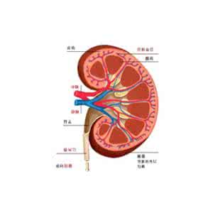 女性肾结石严重吗 女性的肾结石是怎么形成的