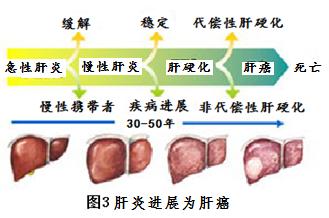 肝癌的形成时间 肝癌是怎么形成的