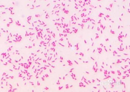 革兰氏阳性菌是什么病 革兰氏菌是什么 什么是革兰氏菌