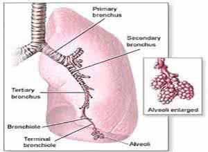 曲霉菌感染肺部致命吗 什么是曲霉感染 曲霉感染是什么原因
