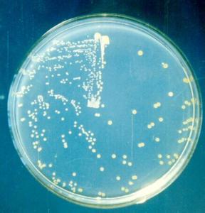 葡萄球菌感染 金黄色葡萄球菌感染的原因 金黄色葡萄球菌的危害