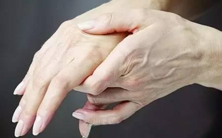 手指尖发麻 手指发麻是五种疾病的信号