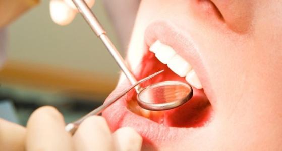 民间治坚固牙齿的偏方 中医8招叫你拥有坚固牙齿
