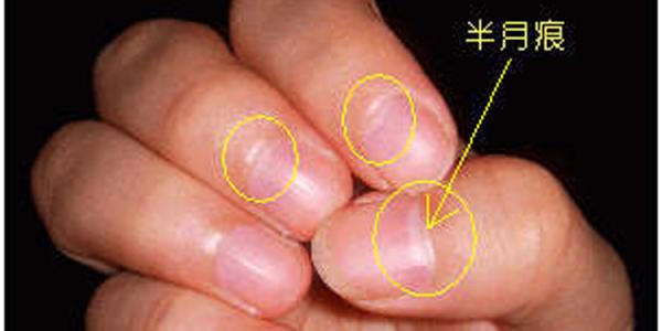 指甲半月痕 指甲上的半月痕与身体有什么关系