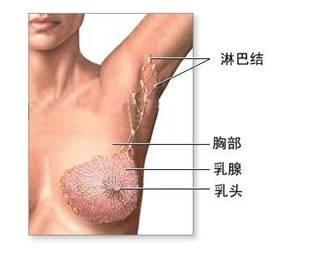 乳腺癌乳房表面长疙瘩 9个细节判断乳房是否患乳腺癌