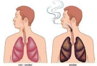 肺气肿不能吃哪些食物 肺气肿不能吃什么 肺气肿不能吃的食物