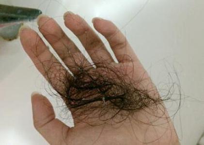 洗头掉70根头发正常吗 洗头掉多少头发算正常