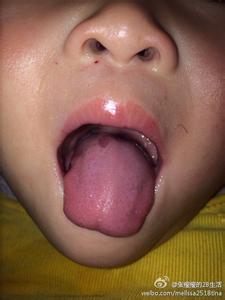 孩子舌头发白怎么回事 孩子玩舌头是怎么回事？