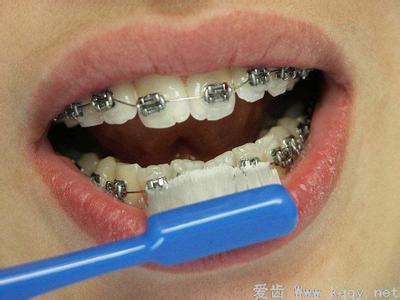 牙齿矫正能不能刷牙 牙齿矫正后可以立刻刷牙吗？