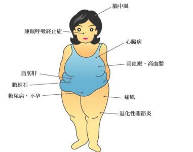 肥胖对女性的几大危害 女性肥胖的危害