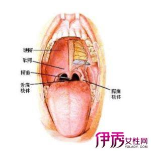 喉炎吃什么药最好 喉炎是什么形成的