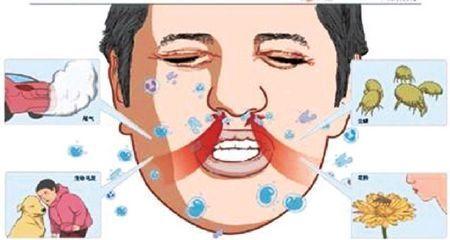 过敏性鼻炎怎么形成的 过敏性鼻炎是如何形成的