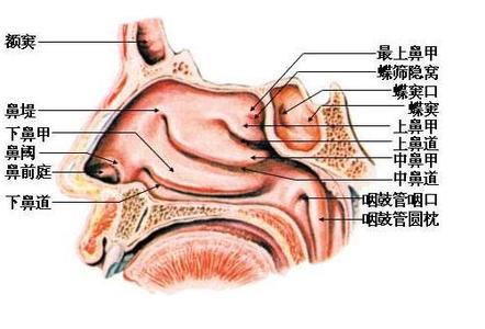 鼻息肉如何形成的 鼻息肉形成的原因