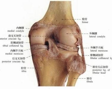 膝盖滑膜炎能自愈吗 膝关节滑膜炎怎么治疗