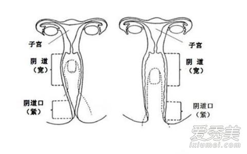 阴道被塞大异物 眼、耳、鼻、阴道内异物的处理