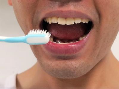 蛀牙刷牙有用吗 每次刷牙至少3分钟_不然容易出现蛀牙
