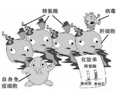 体检前怎样降低转氨酶 如何降低转氨酶