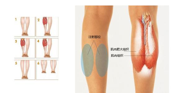 肌肉型腿的瘦腿方法 怎么瘦腿上的肌肉