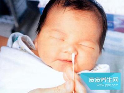 新生儿鼻子堵塞怎么办 新生儿鼻子堵塞怎么办 新生儿出现鼻塞原因及防治方法