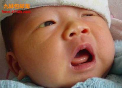 新生儿黄疸是什么原因 新生儿黄疸原因 新生儿黄疸形成原因是什么