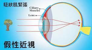 假性近视用什么眼药水 什么是假性近视啊