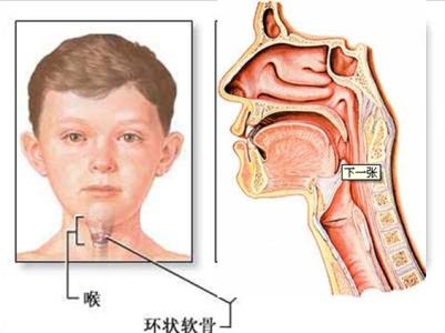 小儿喉炎是什么形成的 小儿喉炎是什么原因导致的