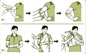 伤口处理方法 小伤口的家庭处理方法